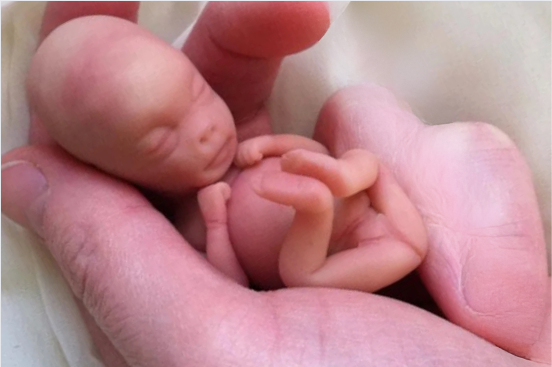 Embryo 11 weeks
