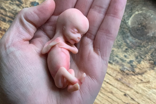 Embryo 11 weeks