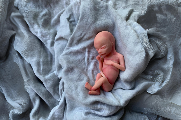 Embryo 18 or 19 weeks