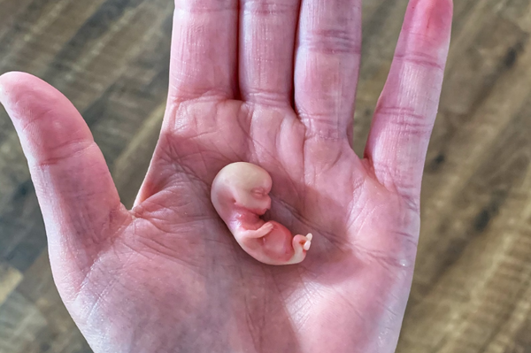 Embryo 9 weeks