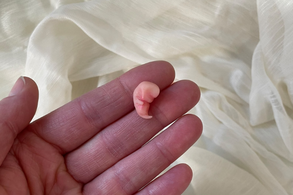 Embryo 7 or 8 weeks