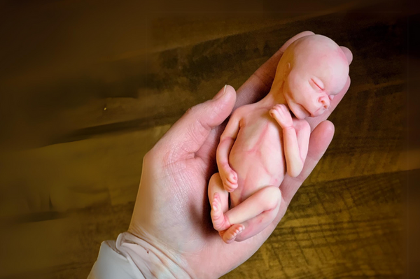 Embryo 16 or 17 weeks