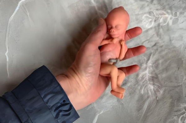 Embryo 18 or 19 weeks