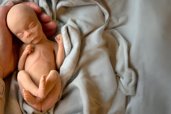 Embryo 20  weeks