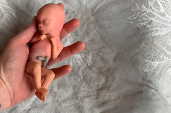 Embryo 18 or 19 weeks