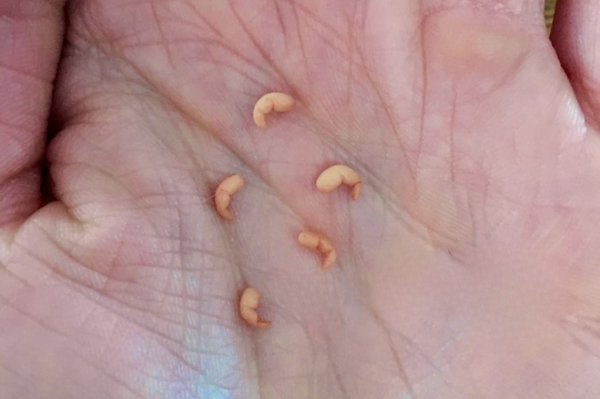 Embryo 4, 5 or 6 weeks