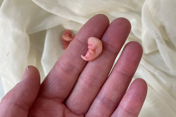 Embryo 7 or 8 weeks