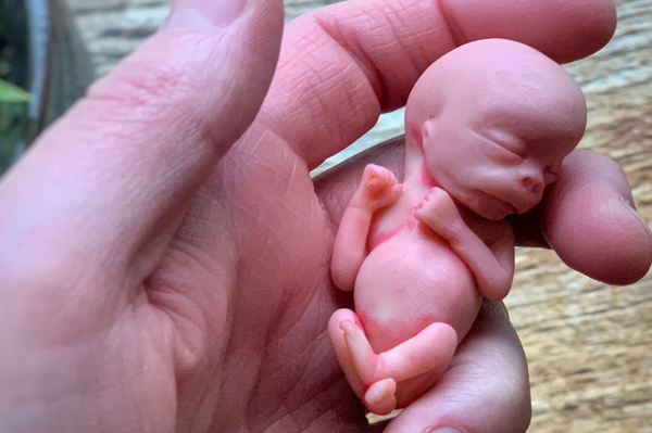 Embryo 12 weeks