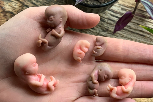 Embryo 9 weeks