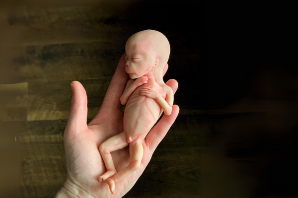 Embryo 18 or 19 weeks