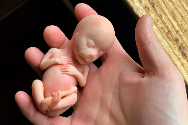 Embryo 13 weeks