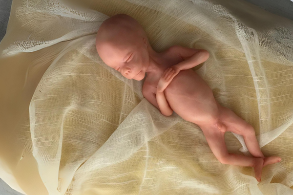 Embryo 16 or 17 weeks