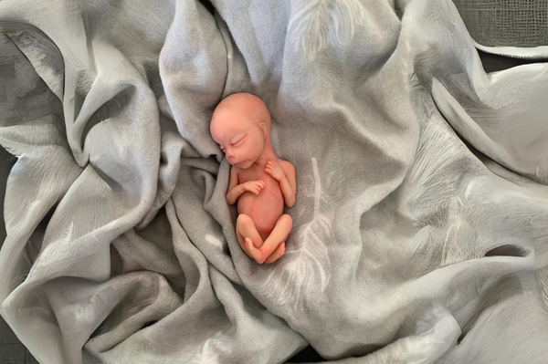 Embryo 16 or 17 weeks