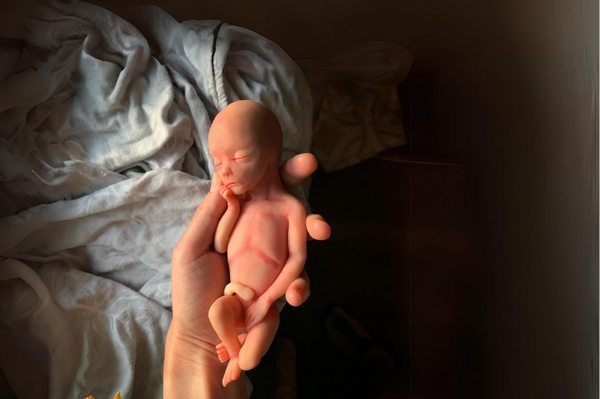 Embryo 20  weeks