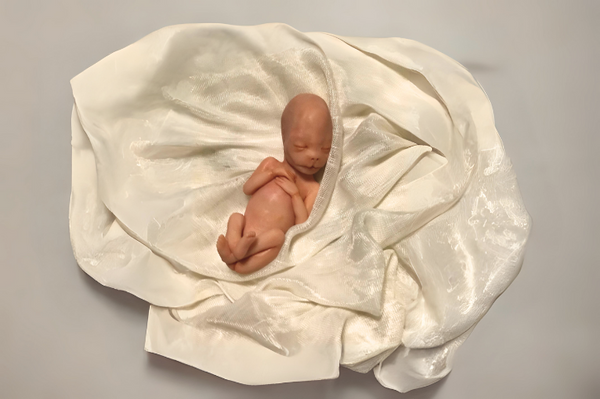 Embryo 14 or 15 weeks