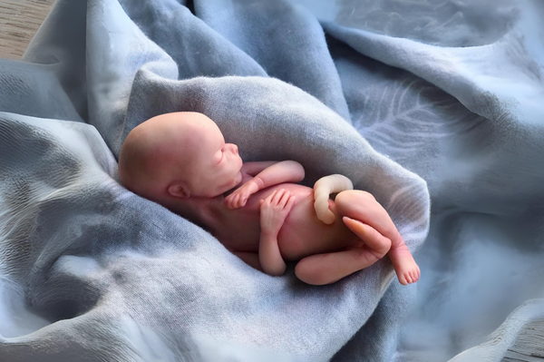 Embryo 16 or 17 weeks