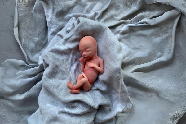 Embryo 20  weeks