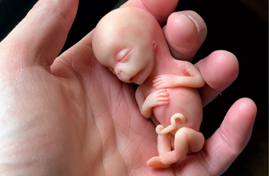 Embryo 11 weeks