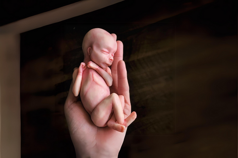 Embryo 20  weeks