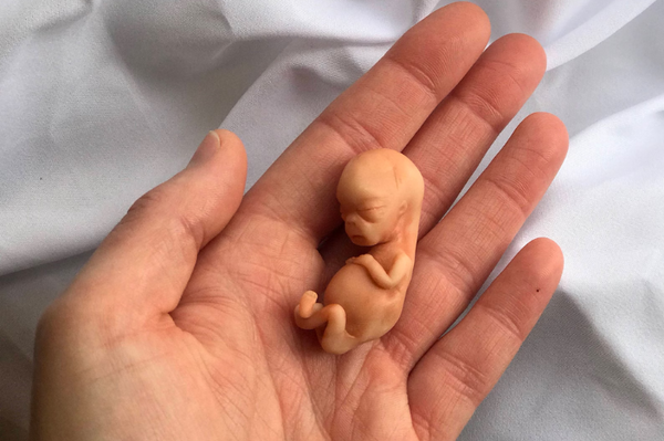 Embryo 10 weeks