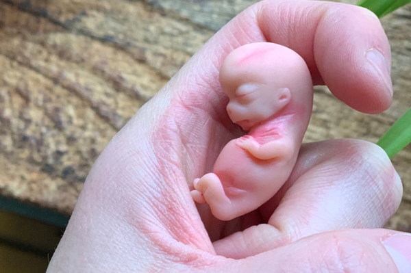 Embryo 9 weeks