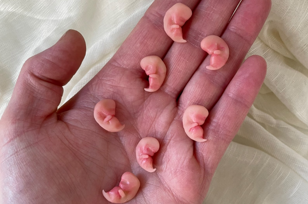 Embryo 7 or 8 weeks