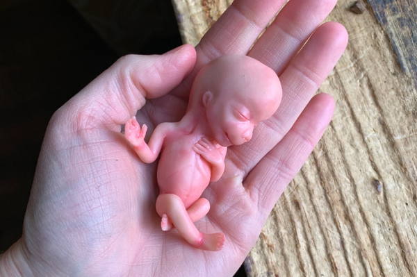 Embryo 12 weeks