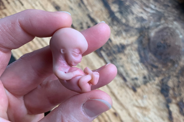 Embryo 10 weeks