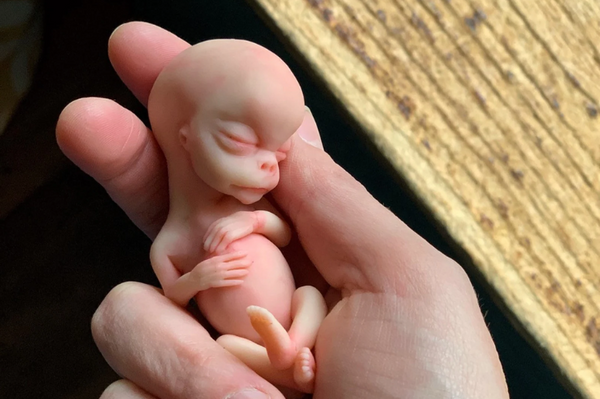 Embryo 13 weeks