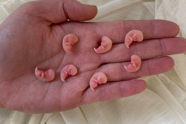 Embryo 7 or 8 weeks