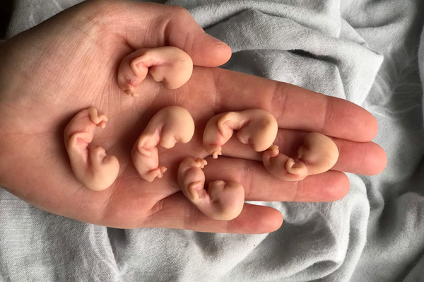 Embryo 9 weeks