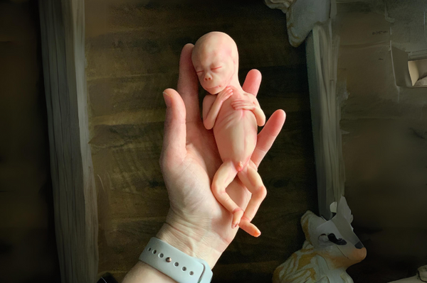 Embryo 18 or 19 weeks