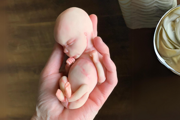 Embryo 16 or 17 weeks